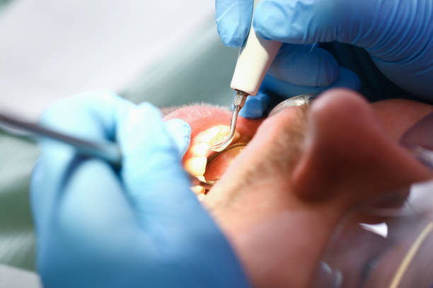 Best Emergency Dental Surgery in Brown City, MI