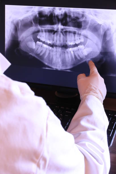 Best Emergency Treatment for Toothache in Brown City, MI