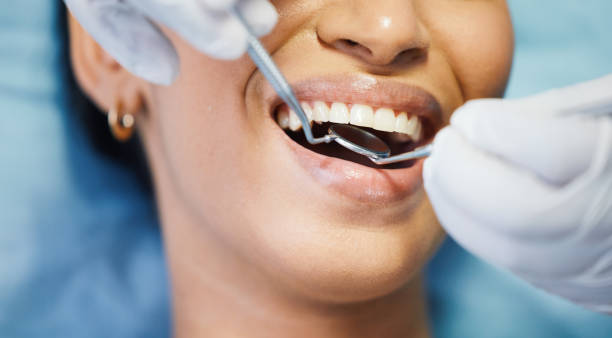 Best Emergency Tooth Extraction in Brown City, MI