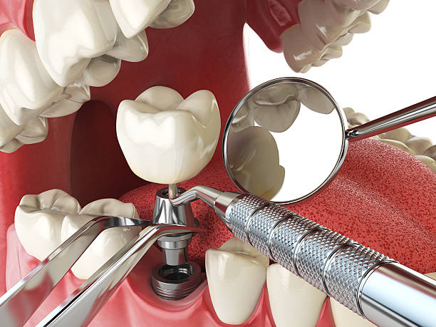Best Emergency Orthodontic Repairs in Brown City, MI